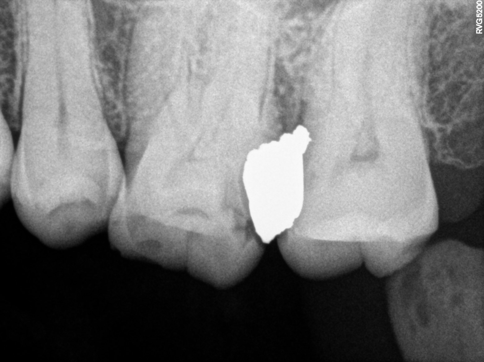 Dental X-ray